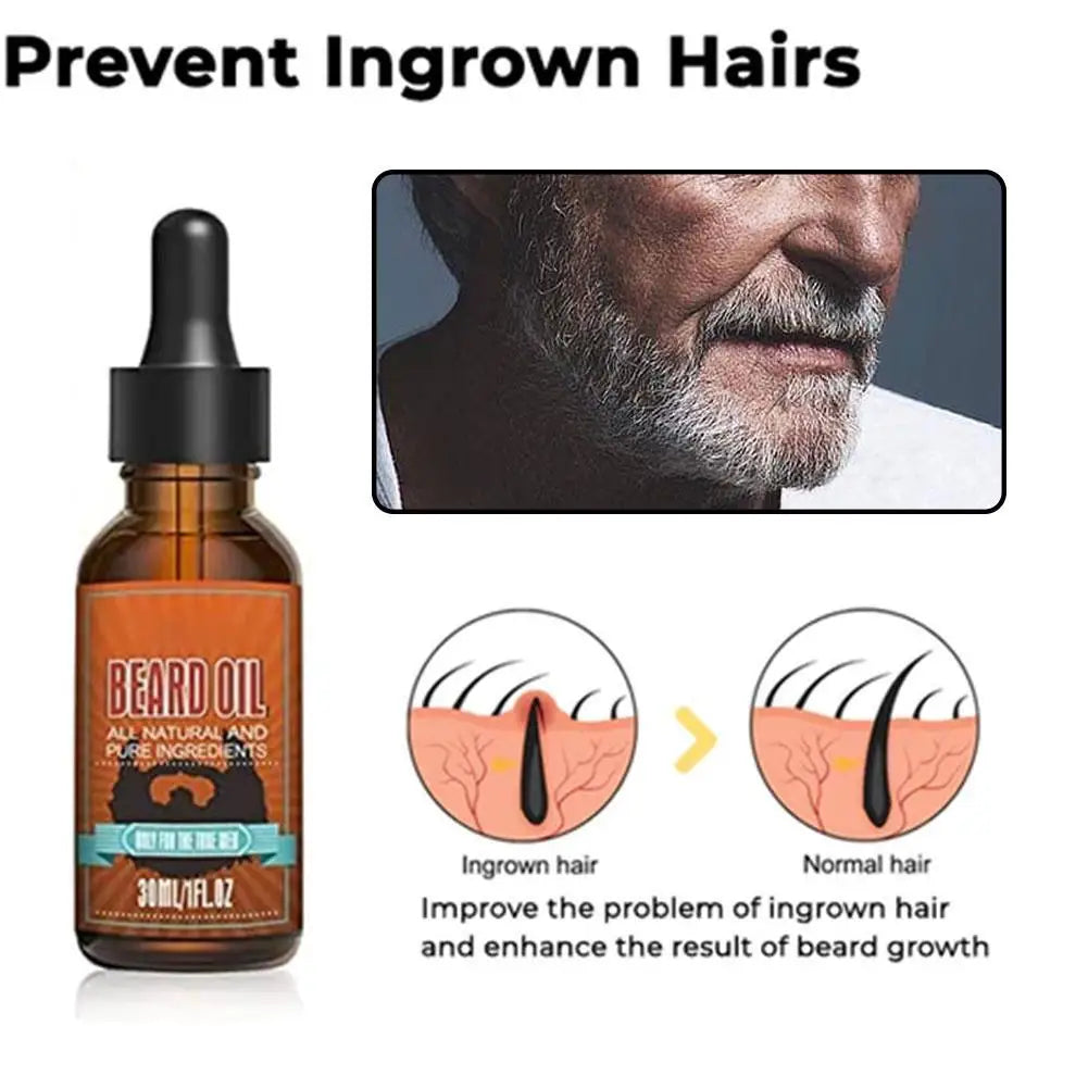 Men's Beard Growth Oil Serum 30ml – Nourishing Softening & Strengthening Beard Oil